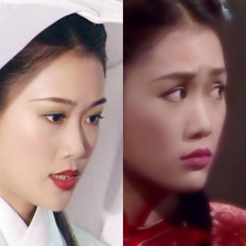 塌鼻梁鼻头大整容会有副作用吗,塌鼻梁凸嘴高颧骨整容