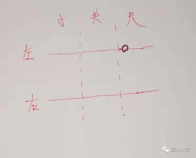 中医把脉入门必背口诀看怀孕,中医号脉怎么判断流产