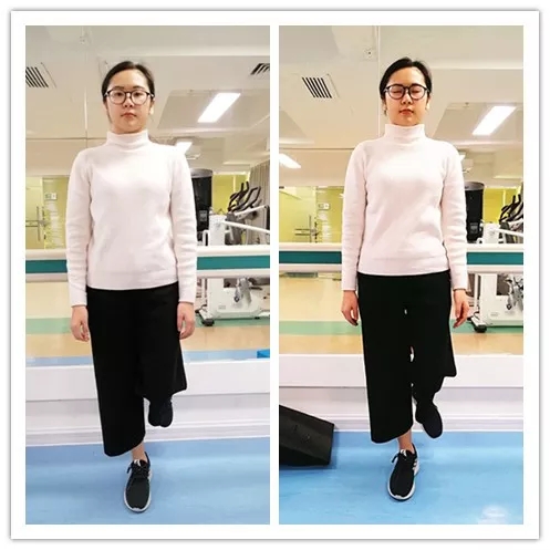 崴脚不当回事小心遗憾终生,莫把崴脚当小事