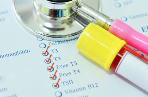 甲状腺功能减退如何减肥,甲状腺功能减退怎么调理瘦肚子