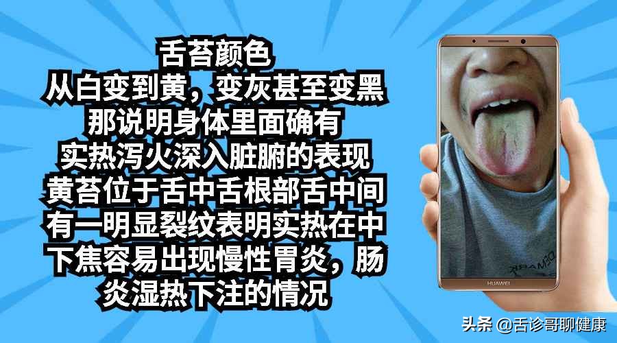 舌诊歌舌象分析与感悟,抖音舌诊哥舌象分析