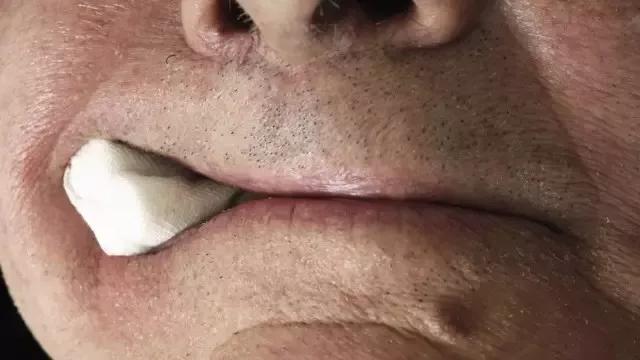 拔牙打麻药会影响恒牙的发生吗,拔牙时打麻药会不会引起口腔溃疡