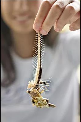 广州一女子误吞鱼骨致动脉破裂命悬一线！鱼刺为何频惹大祸？