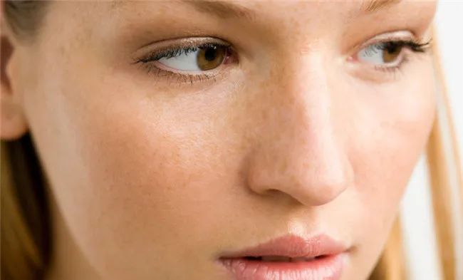 产后淡化细纹斑点霜,产后肚子长了很多斑点咋回事