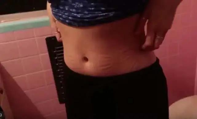 减肥束腰收腹神器危害,束腰有助于减肥吗