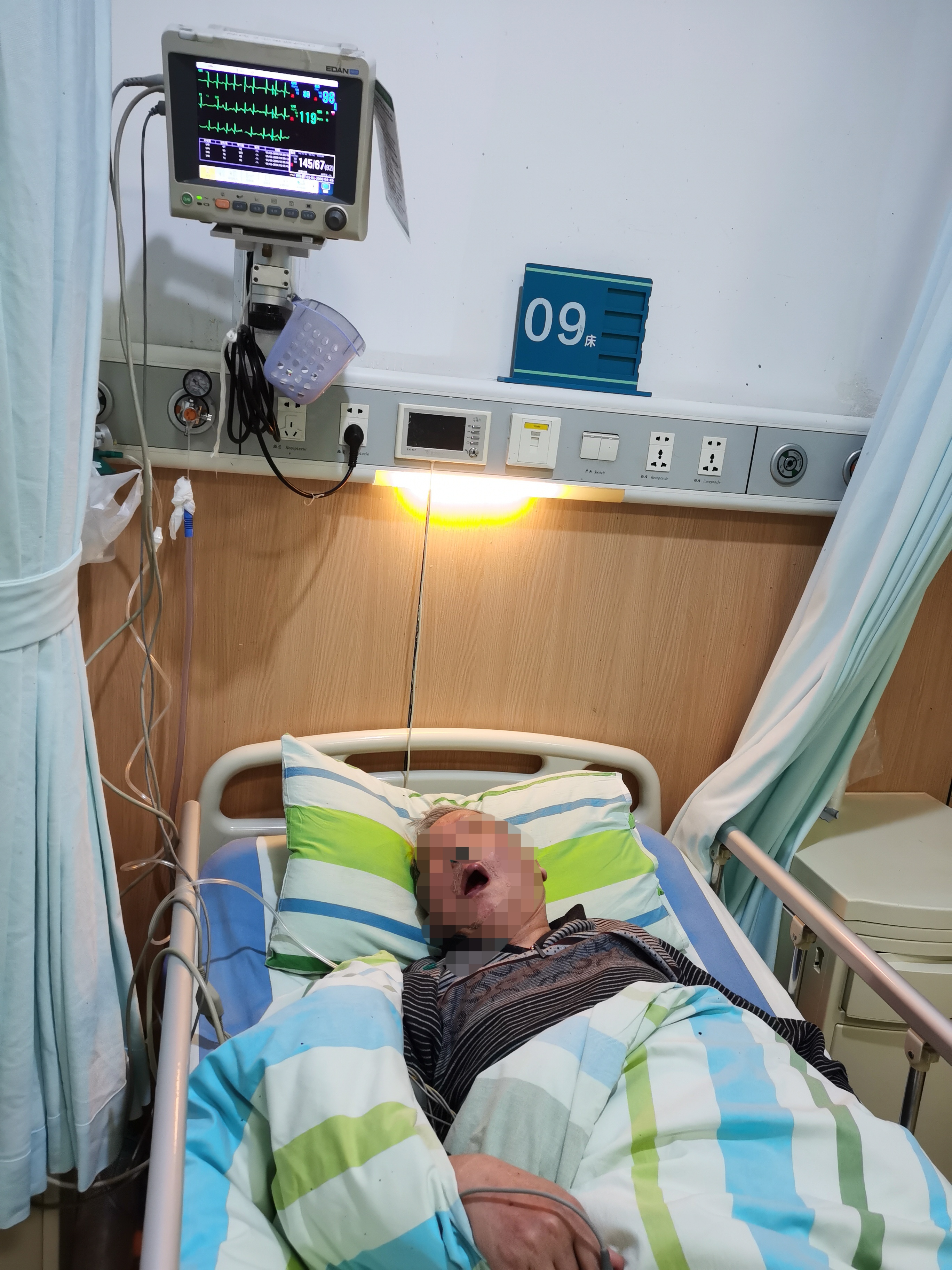 65岁男子，脑梗瘫痪，医生：睡觉常有4个异常，可能脑梗来临