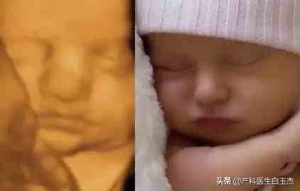 做四维彩超能看到胎儿图片吗,四维彩超图片就是胎儿的样子吗