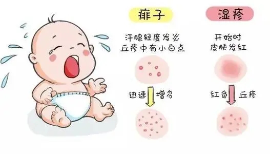 6月份出生的宝宝怎么预防痱子,母婴好物天热了宝宝爱长痱子