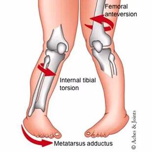 为什么日本女人走路时要低头,走路有尿急的感觉