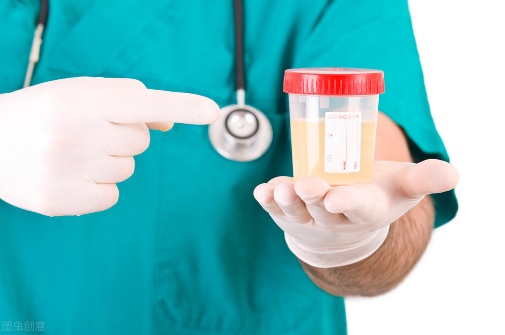 尿蛋白2+尿潜血3+怎么回事严重吗,单纯尿潜血3+尿蛋白2+肾功能正常