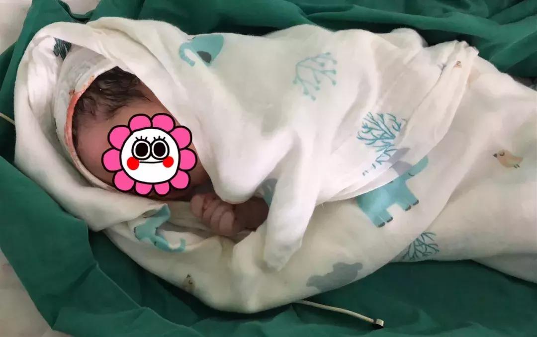 公布抢救记录脐带脱垂产妇获救,产妇突发脐带脱垂胎儿命悬一线