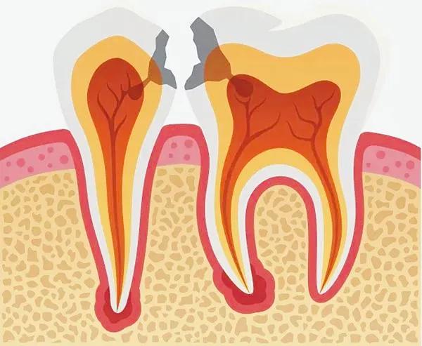 小伙吃未熟烤全羊,小伙吃龙虾牙齿崩了
