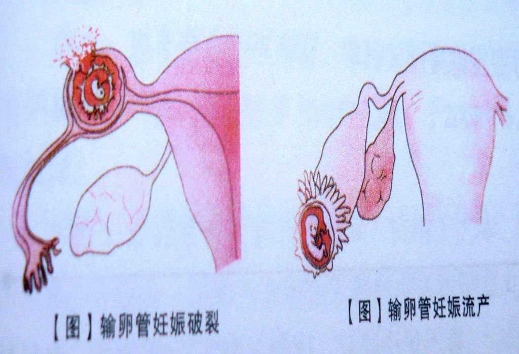 孕期为什么会感觉肚子有点痛,孕期肚子有阵痛