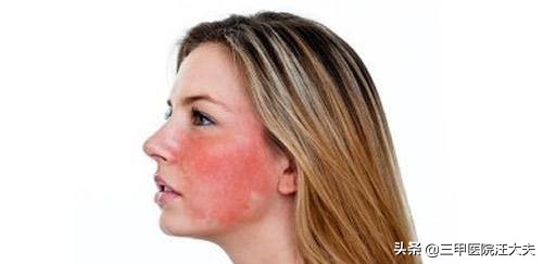 喝酒脸白的人比脸红的人更危险吗,喝酒脸红的危险