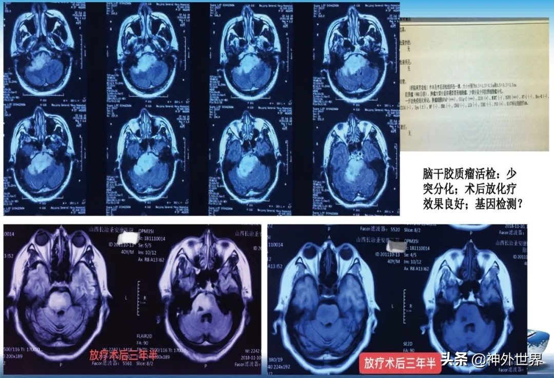宣武医院神经外科王亚明祖籍,北京宣武医院神经科专家王亚明