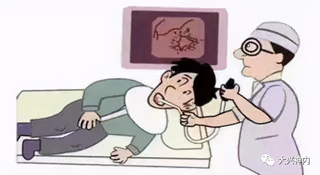 苗建亭教授：预防脑梗死的药物选择