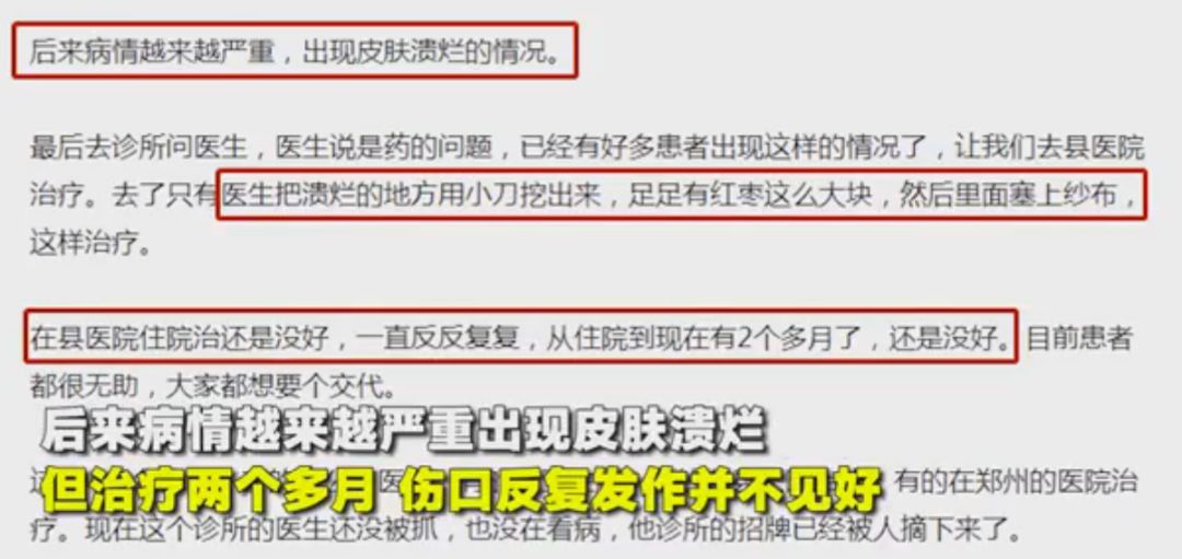 针灸后感染病例,针灸后针孔化脓