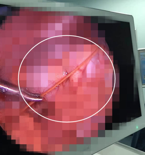 竹凉席对宝宝的危害,竹席有倒刺可以彻底去除