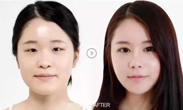 把水光针当饭吃？这位网红简直丧心病狂！整容后年入千万