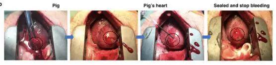 纳米技术让伤口快速愈合的凝胶,神奇胶水60秒缝合伤口