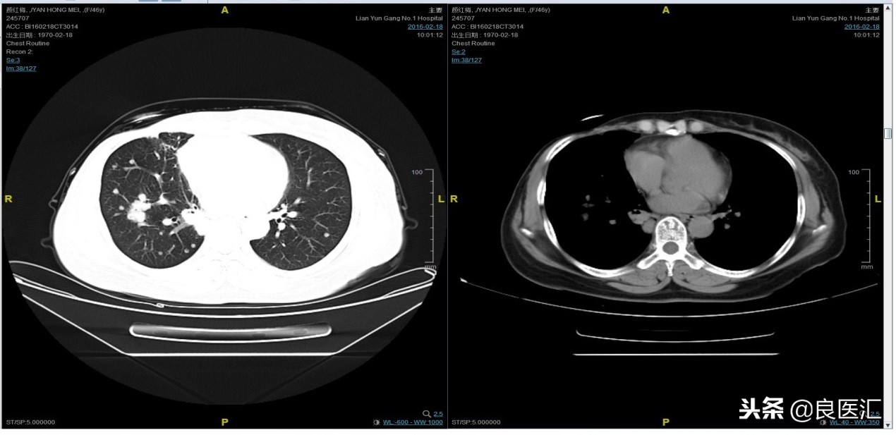 美图秀秀成功案例,美图秀秀实战案例