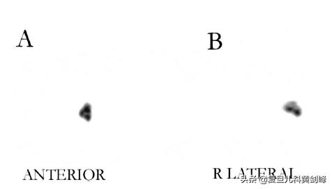 孩子洗鼻子用什么药水,洗鼻子正确方式