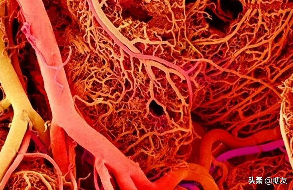 糖尿病磁疗穴位贴,磁疗治疗糖尿病最新成果