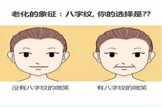 眼纹法令纹如何消除,鼻翼法令纹如何消除