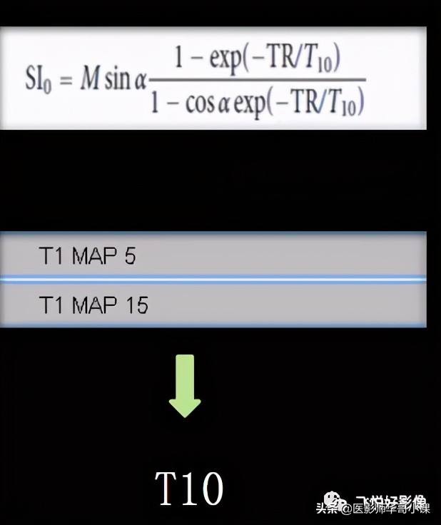 飞利浦磁共振系统界面及操作流程,飞利浦磁共振技术学习