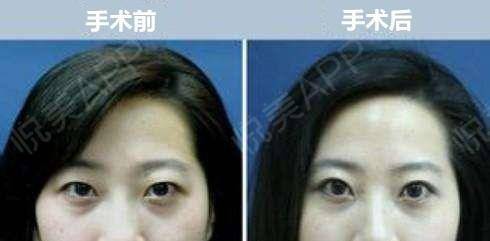 人衰老面部变化,面部衰老改善最好的方法