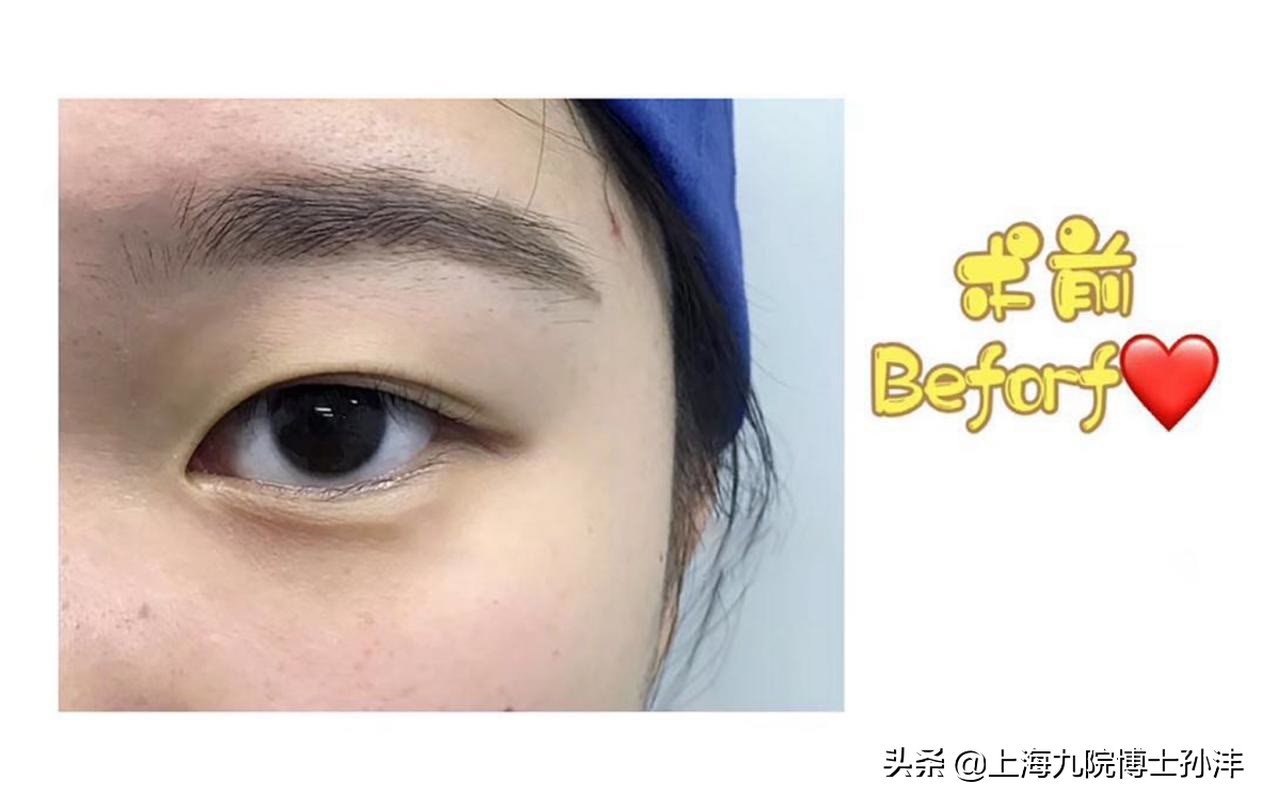 瀛欐玻鍗氬＋妗堜緥,瀛欐玻鍗氬＋