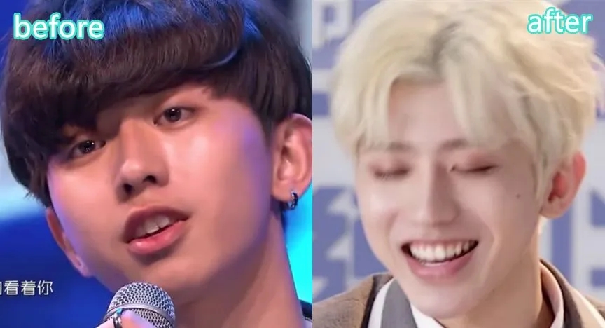 蔡徐坤整牙前后对比图片,蔡徐坤整牙前图片