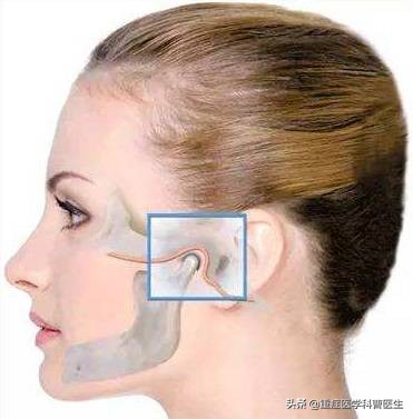 伤口在哪种情况下容易感染破伤风,一般哪种伤口比较容易感染破伤风