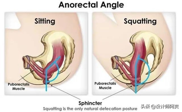 蹲便好还是马桶好介绍,是蹲厕更方便还是马桶更方便