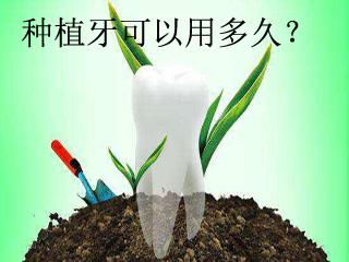 种植牙和烤瓷牙究竟有哪些区别?为什么都说种植牙好?