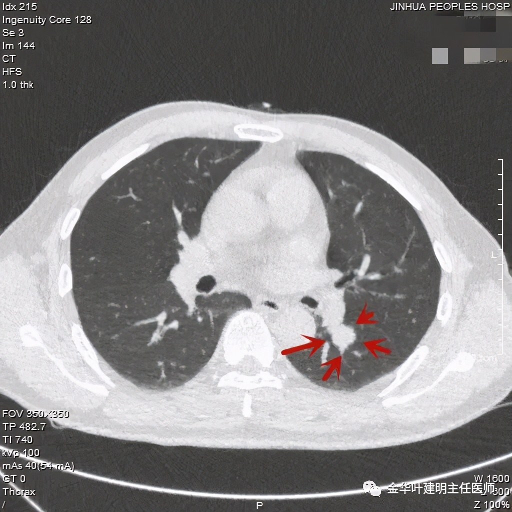 放个大招完整版教学,放个大招完整版前奏