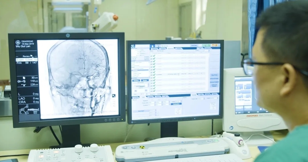 如何减少脑梗发病率,脑梗病情加重还有啥好的治疗方法