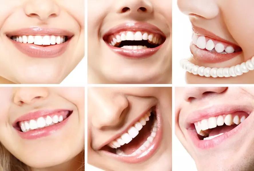 牙齿矫正隐形和普通的有什么区别,隐形牙齿矫正好第一步应该干什么