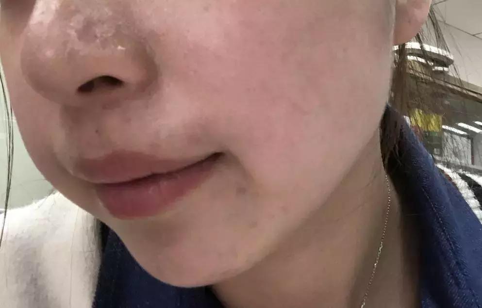 适合皮肤暗黄的护肤品李佳琦推荐,淡斑提亮肤色李佳琦推荐