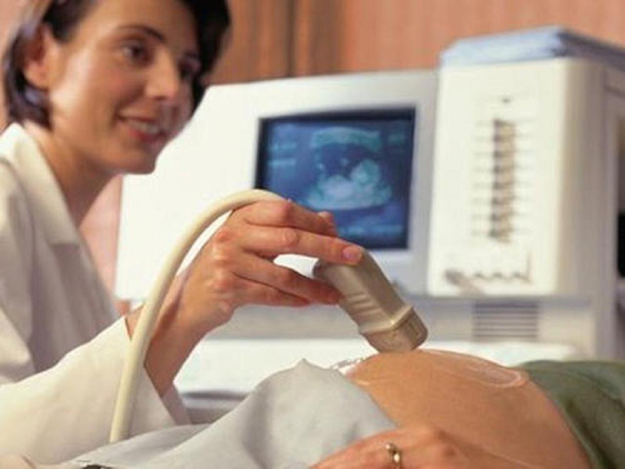 忘了月经时间怎么算预产期,预产期忘了怎么算