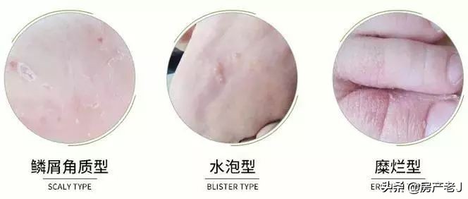 鞋子臭的最佳办法快速不臭,去除鞋臭一小时就能解决