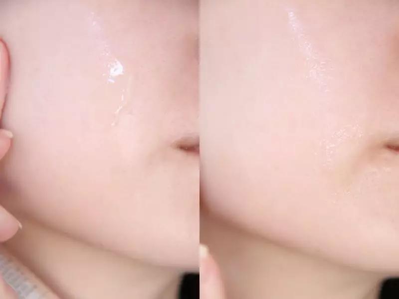 沈梦辰透露自己变白的方法,男朋友说你黑啥意思