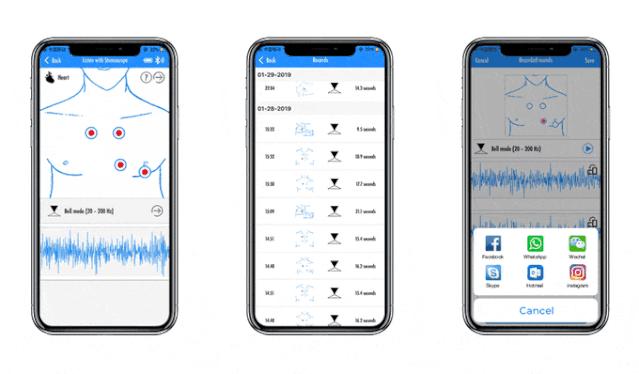 鍚瘖鍣ㄧ殑澹伴煶濡備綍褰曢煶,濡備綍鐢ㄥ惉璇婂櫒褰曢煶