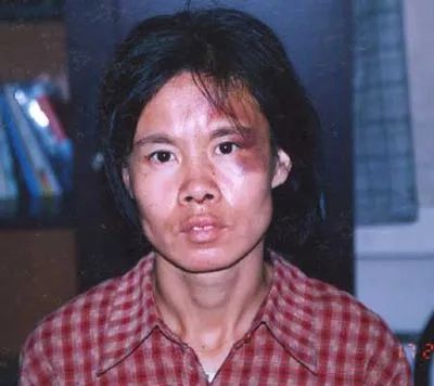 不堪忍受丈夫家暴完整版,不堪丈夫长年家暴后续