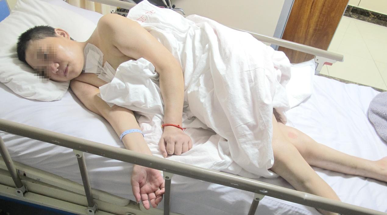 脑脓肿合并脑膜炎需要手术吗,脑脓肿进入左侧脑室严重吗