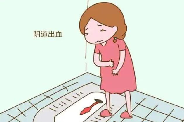 孕早期有点出血会导致流产吗,孕早期阴道出血症状正常吗