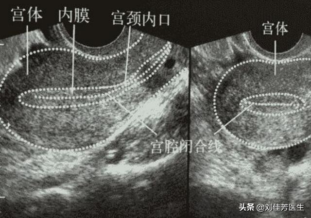 导致女性不孕的九大杀手,内膜薄导致不孕要注意这几个方面