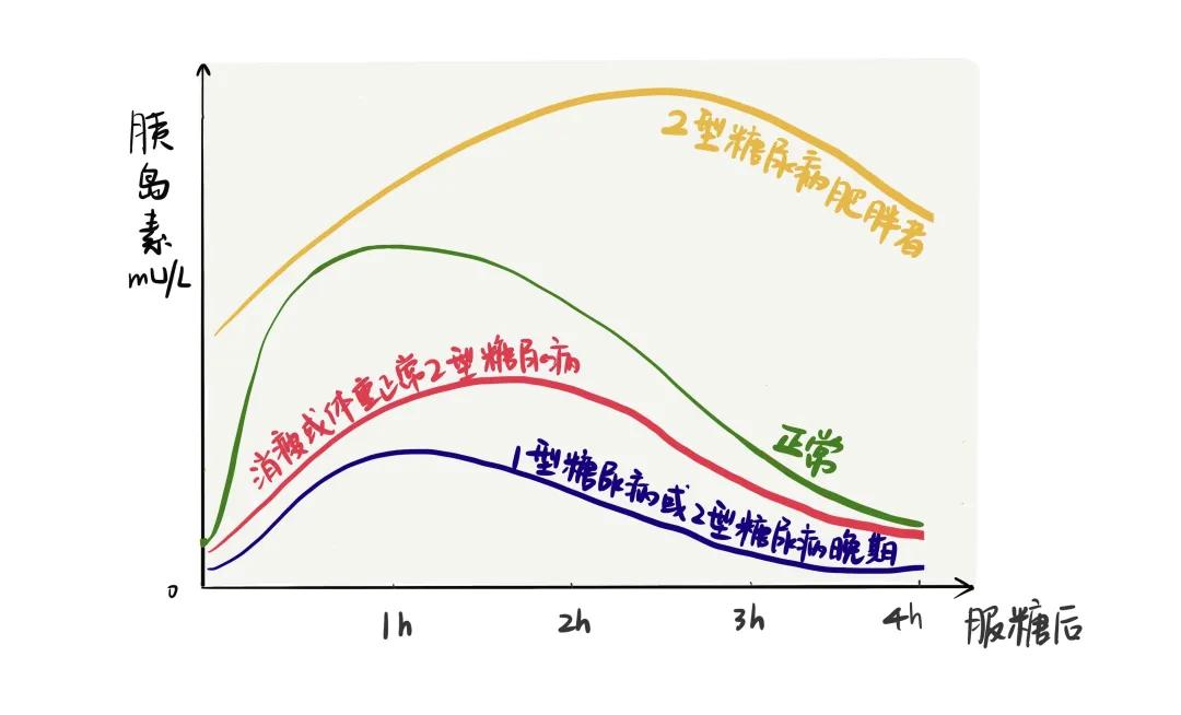 糖尿病胰岛素与c肽化验正常,空腹胰岛素和c肽正常还是糖尿病
