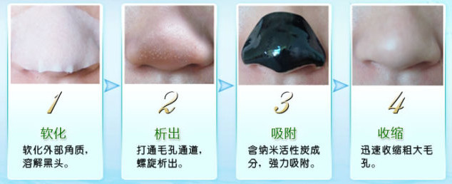 轻松吸出黑头,怎样导出鼻子黑头