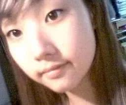 整容失败的后遗症有多严重,整容失败最严重的后遗症